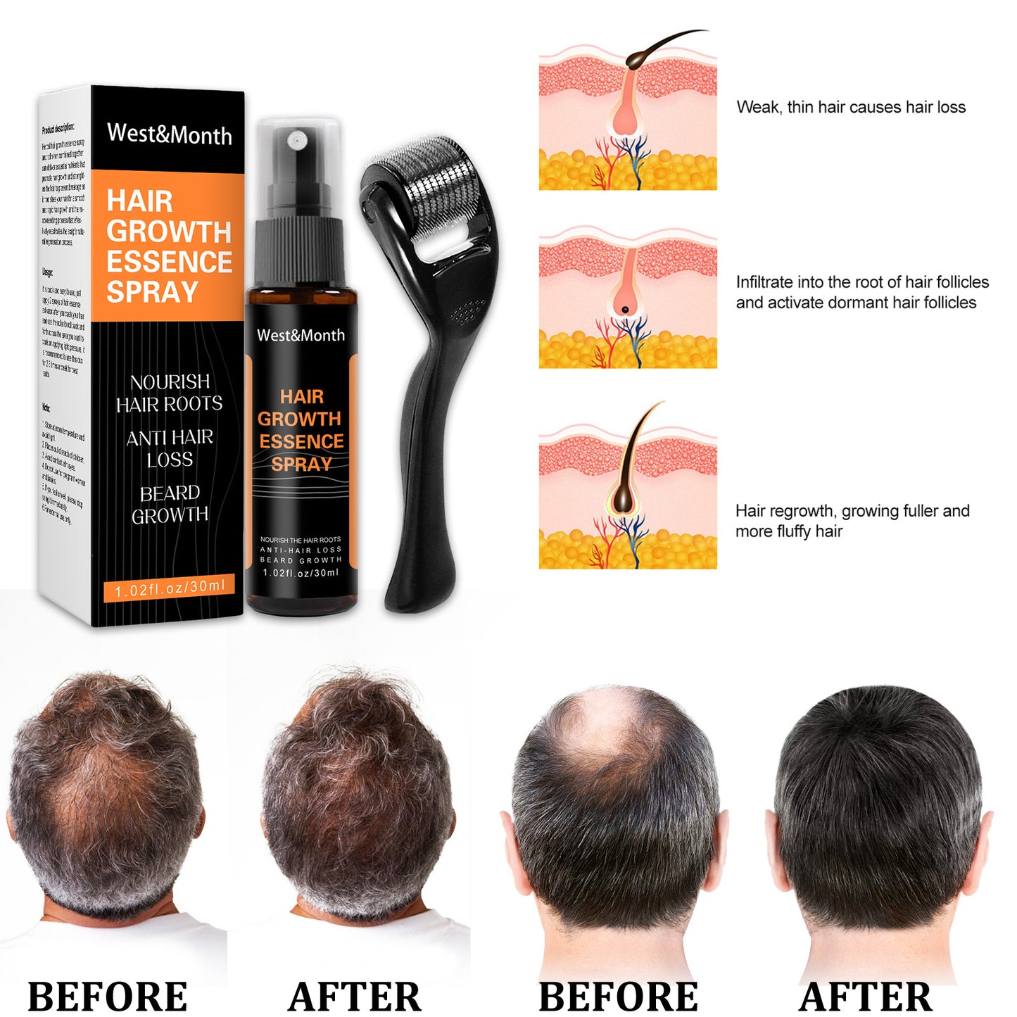 Spray Pousse Cheveux Anti-Chute (Résultats Rapides)